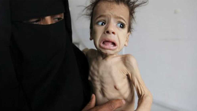 12 مليون يمني معرضون  للمجاعة